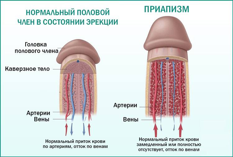 Что Делать Если Болит Член После Секса Что Делать Если Болит Член После Секса