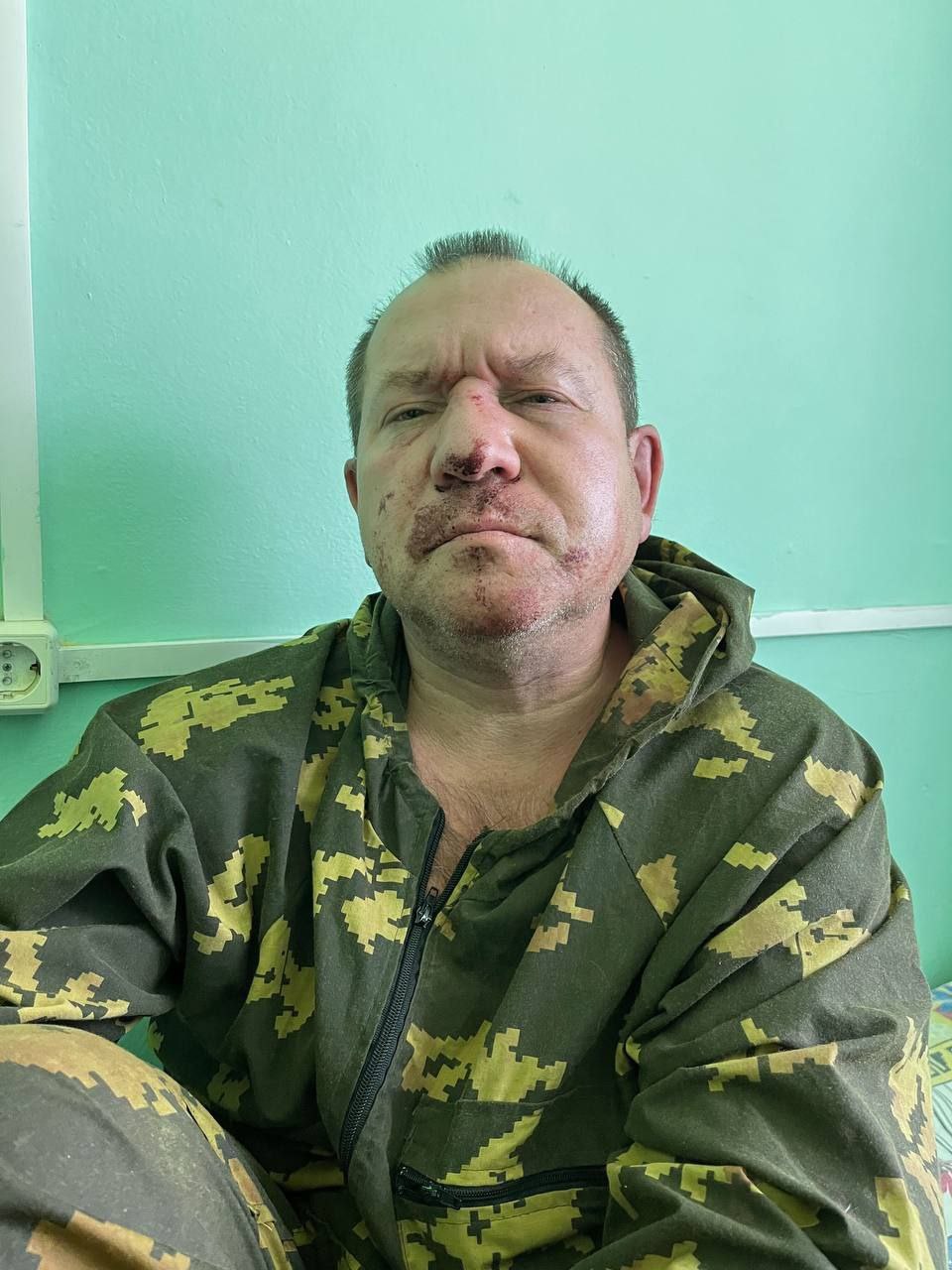 Экс-глава Комитета против пыток Игорь Каляпин после нападения неизвестного