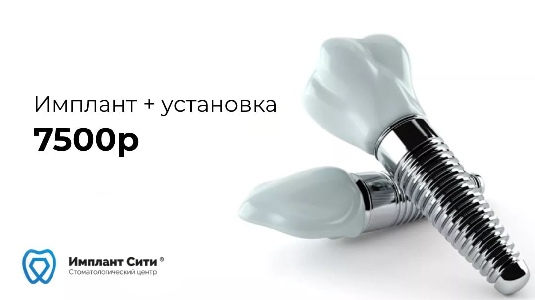 Акции по имплантации в стоматологии. Акции по имплантации в стоматологии. Имплантация акция. Пакет акций для имплантатов. Акции установка имплантов.